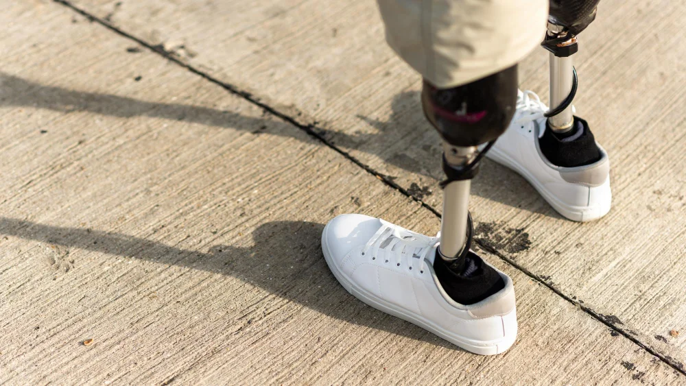 Custom Braces and Orthotics